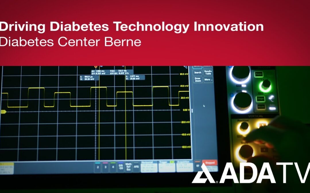 DCB bei ADA TV: Innovationsförderung in der Diabetes-Technologie