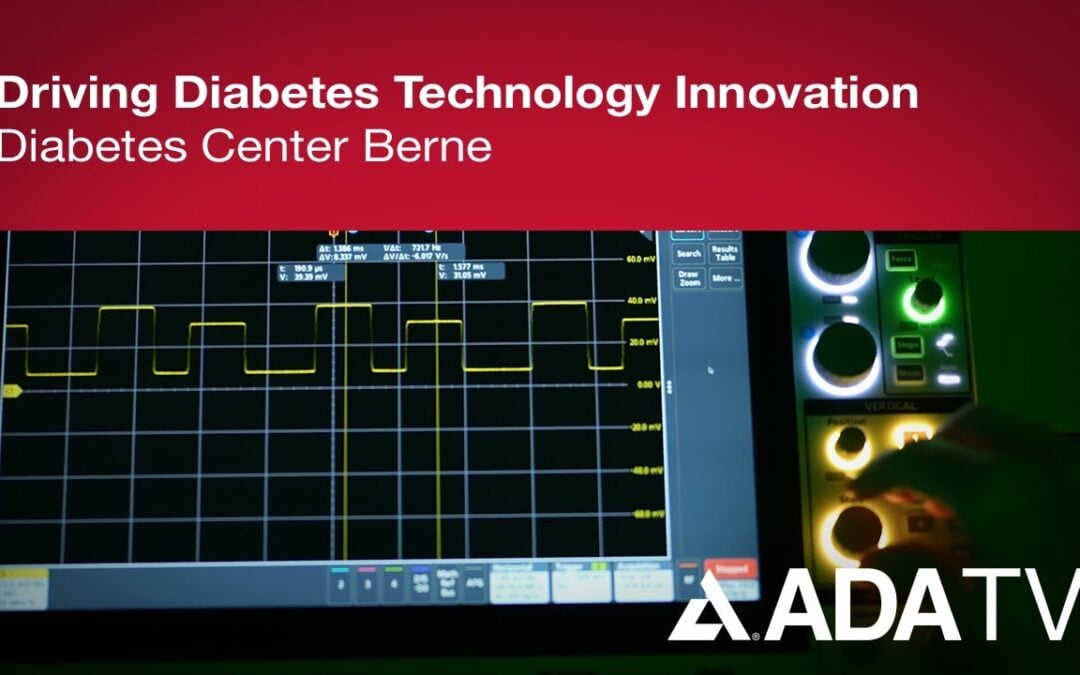 DCB bei ADA TV: Innovationsförderung in der Diabetes-Technologie